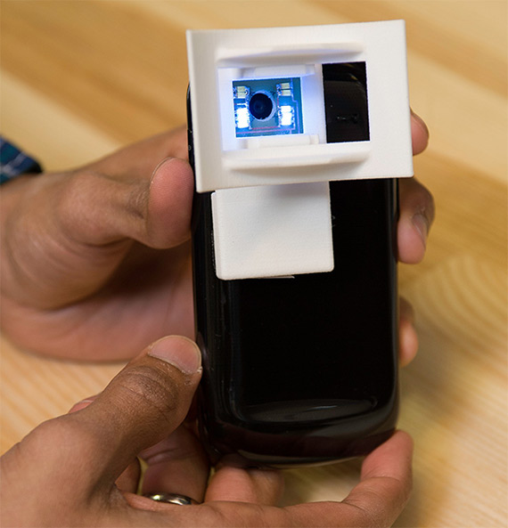 , OScan, Συσκευή που λειτουργεί με smartphones εξετάζει για καρκίνο του στόματος