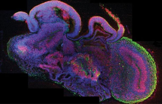 ανθρώπινος εγκέφαλος, Επιστήμονες δημιουργούν μίνι ανθρώπινους εγκεφάλους
