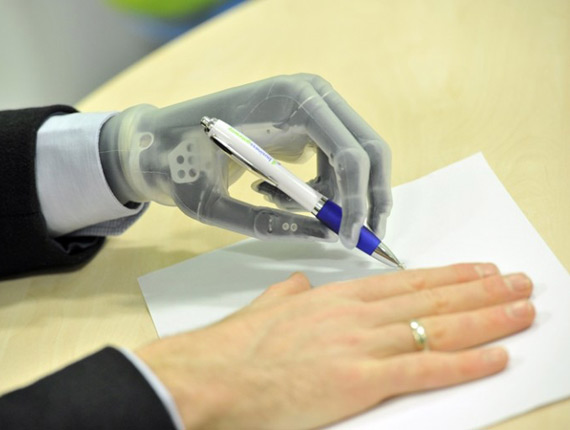 , Touch Bionics i-limb Ultra Revolution, Προσθετικό χέρι με έλεγχο μέσα από application
