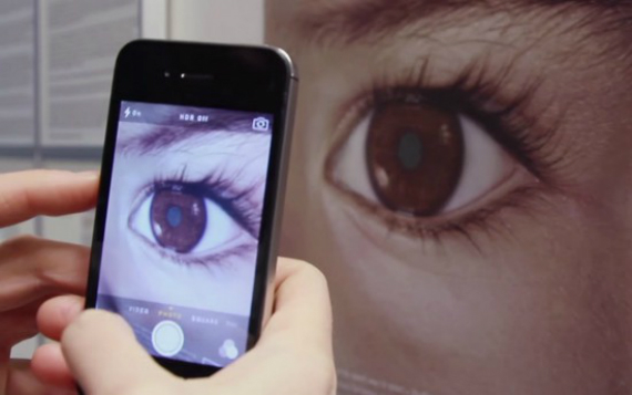Smartphones εντοπίζουν καρκίνο στο μάτι, Smartphones εντοπίζουν καρκίνο στο μάτι [video]