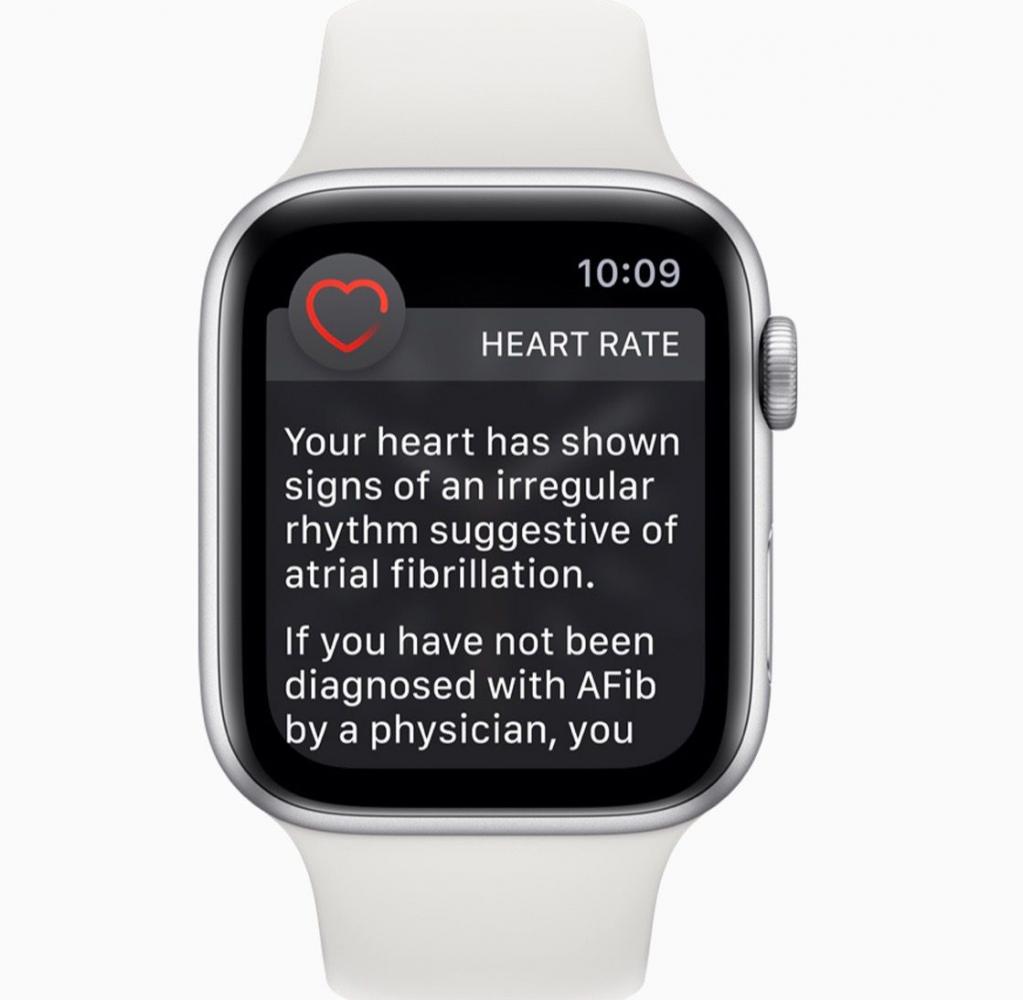 Apple Watch αρυθμίες, Το Apple Watch μπορεί να εντοπίσει καρδιακές αρρυθμίες