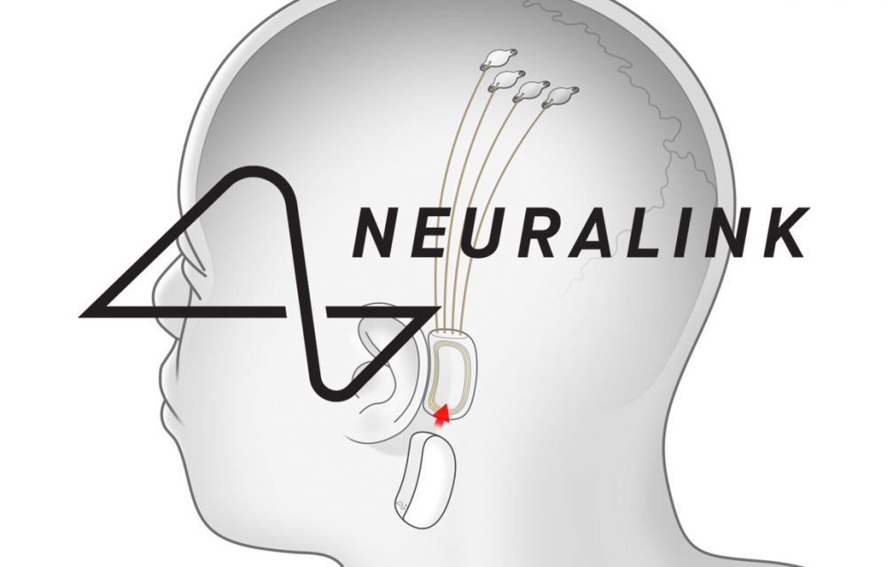 Neuralink, Neuralink: Εγκεφαλικά εμφυτεύματα που επιτρέπουν τον απομακρυσμένο έλεγχο συσκευών