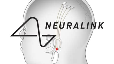 Neuralink: Κατηγορείται για πειράματα – βασανιστήρια σε πιθήκους