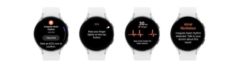 samsung galaxy watch 6, Samsung Galaxy Watch 6: Θα ειδοποιεί για ακανόνιστο καρδιακό ρυθμό